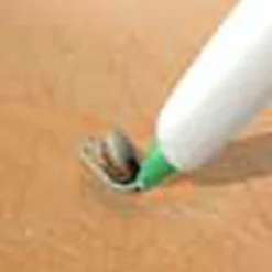 3iX ZeckenSchlinge, Das Original -CampGlück Verkäufe 3ix zeckenschlinge das original5